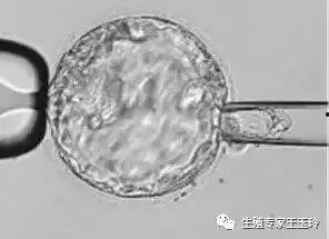 囊胚移植后吃小瓜,孕育新生命之旅